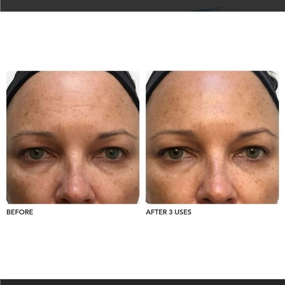 NEW Algenist Blue Algae Vitamin C Dark Spot Correcting Peel - Picture 7 of 12